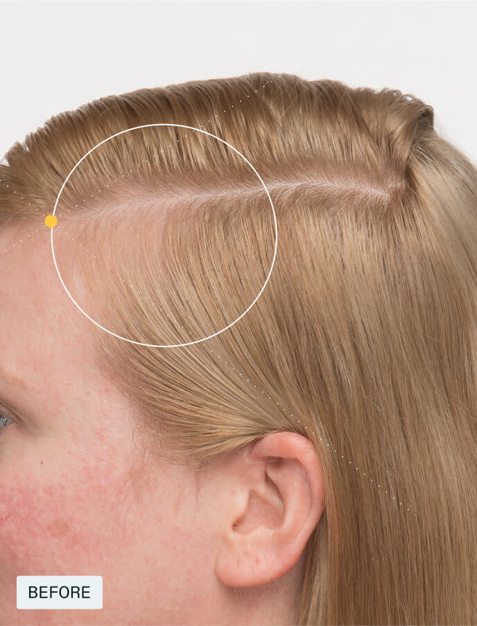 Nutrafol Women's Balance Hair Growth System Supplement